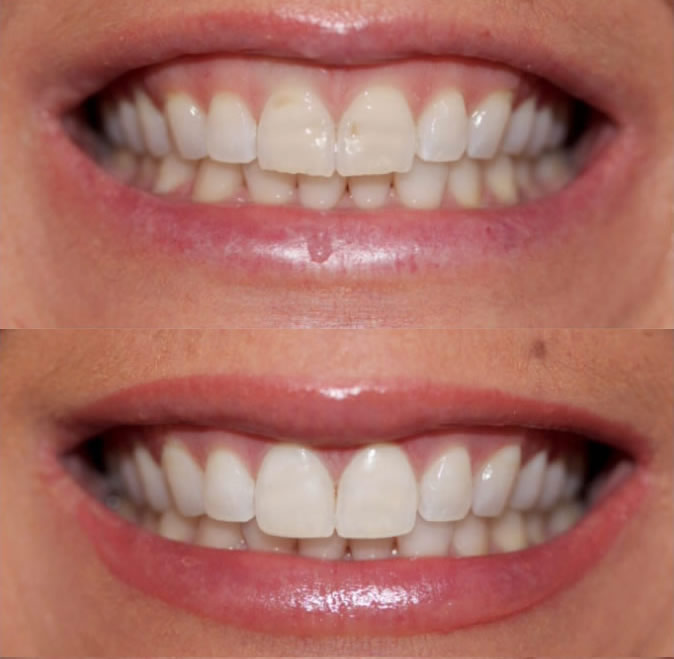 Best Cosmetic Dentistry New York Dentist Nyc Cosmetic Dentist New